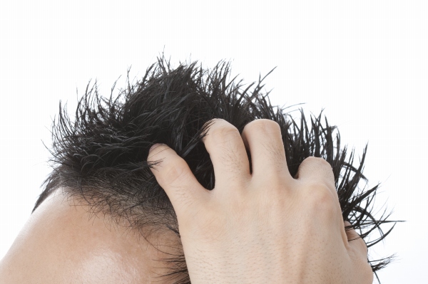 AGA（男性型脱毛症）の治療